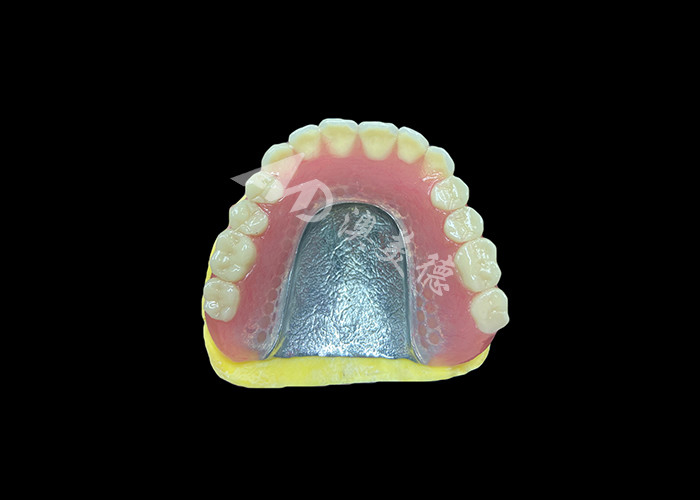 Dentaduras parciales fundidas diseñadas para la durabilidad, la comodidad y la estética y duran más tiempo