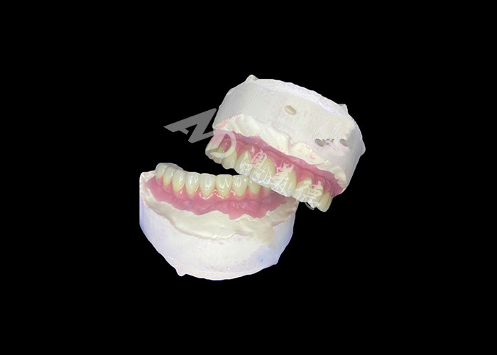 Dentistas con implantes dentales All-on-6 con estabilidad y comodidad