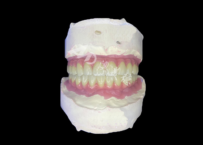Dentistas con implantes dentales All-on-6 con estabilidad y comodidad