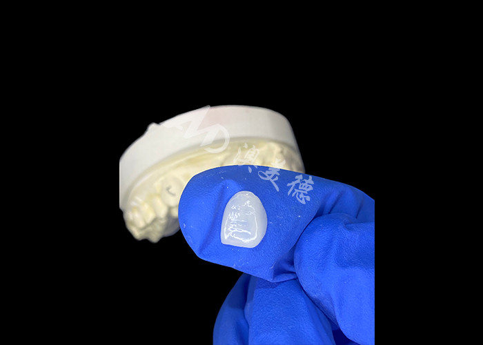 IPS e.max Carillas para incisores en tono A1 Estética natural para sonrisas impecables