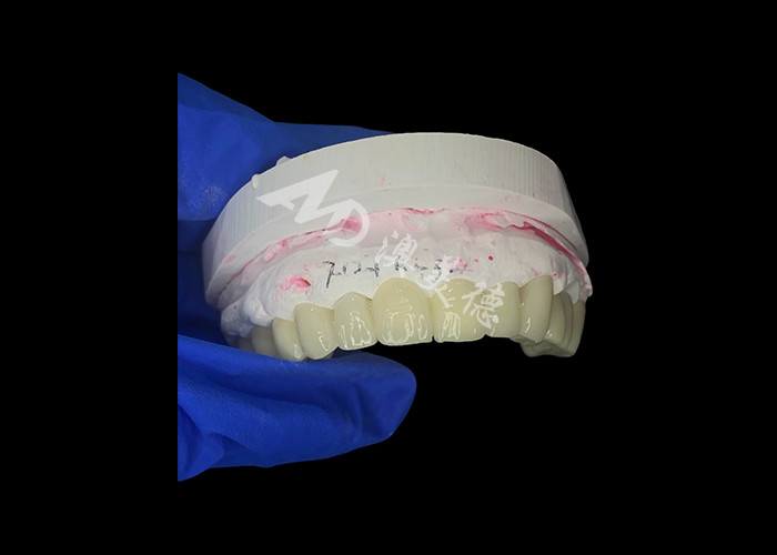 Puente dental de zircónia de alta translucidez Fuerte y natural para la restauración de la sonrisa sin fisuras