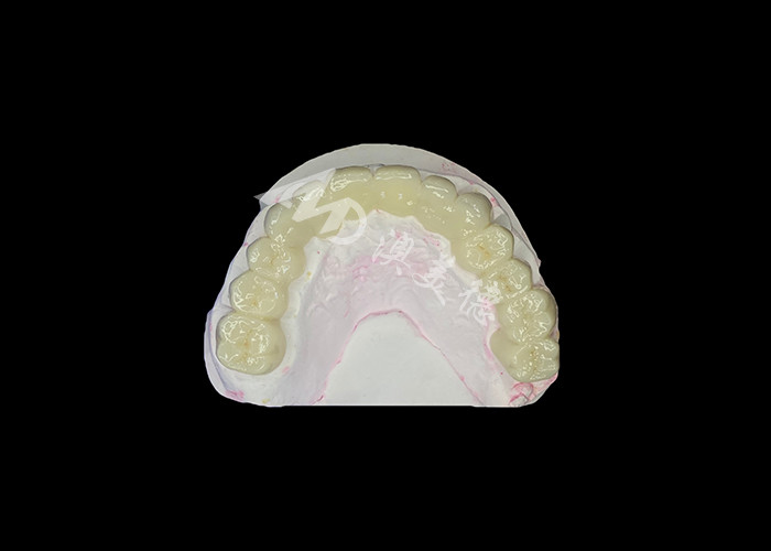 Puente dental de zircónia de alta translucidez Fuerte y natural para la restauración de la sonrisa sin fisuras