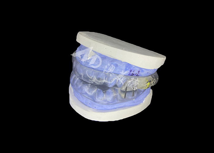 Dispositivo anti-ronquido de tiburón Dispositivo de avance mandibular ajustable para mejorar el alivio del ronquido y mejorar el sueño