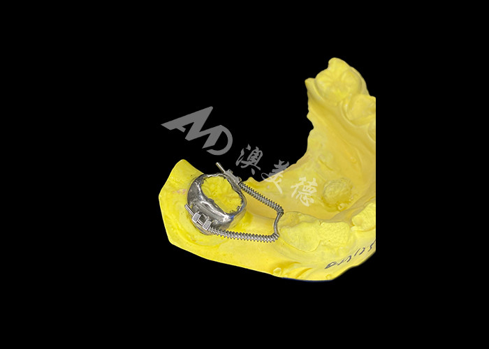 Recuperador de bucle deslizante para una recuperación de espacio efectiva y un movimiento de dientes preciso para lograr una alineación óptima en los tratamientos de ortodoncia