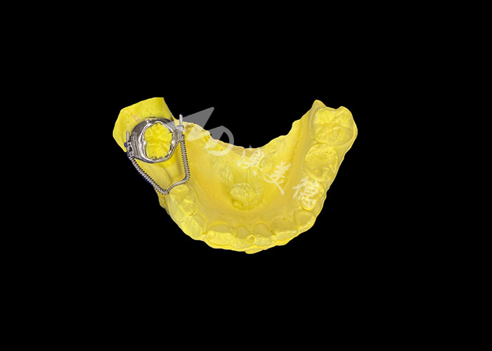 Recuperador de bucle deslizante para una recuperación de espacio efectiva y un movimiento de dientes preciso para lograr una alineación óptima en los tratamientos de ortodoncia