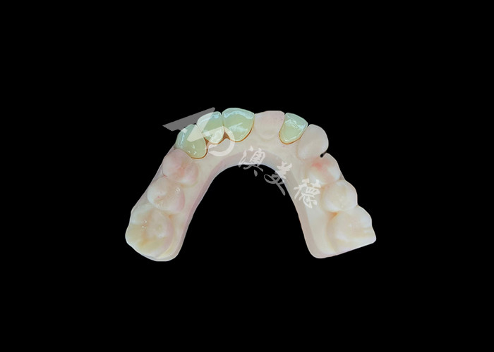 Naturales y cómodos ajuste de porcelana de zirconia corona China laboratorio dental sombra personalizable