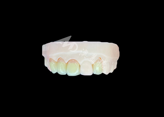 Naturales y cómodos ajuste de porcelana de zirconia corona China laboratorio dental sombra personalizable