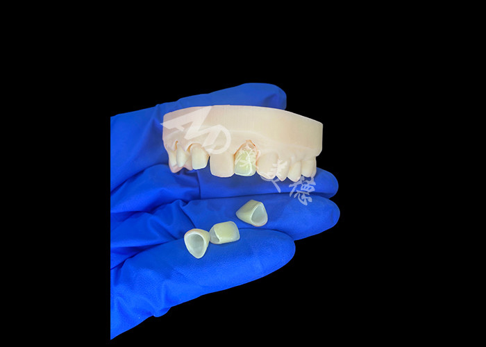 Naturales y cómodos ajuste de porcelana de zirconia corona China laboratorio dental sombra personalizable