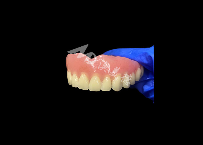Dentadura acrílica de arco completo Una solución asequible para las necesidades internacionales de dentadura extraíble