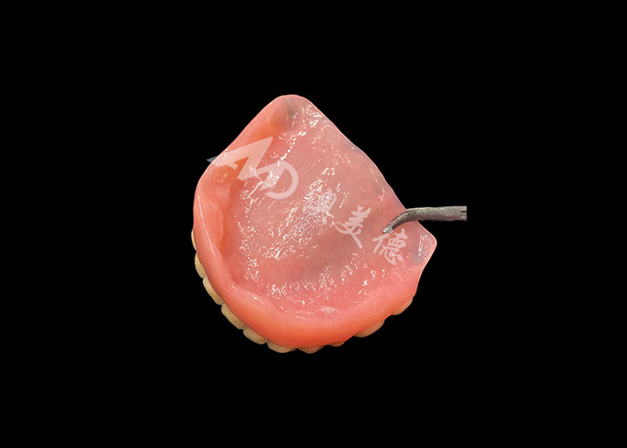 Dentadura acrílica de arco completo Una solución asequible para las necesidades internacionales de dentadura extraíble