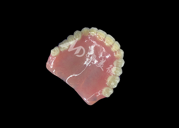 Dentadura acrílica de arco completo Una solución asequible para las necesidades internacionales de dentadura extraíble