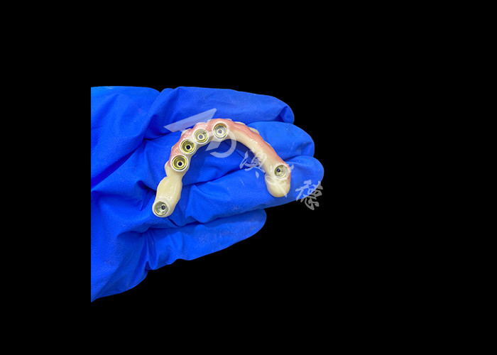 Abutment de titanio e implante de corona de zirconia Dentes postizos con soporte Precisión adecuada para el uso cómodo