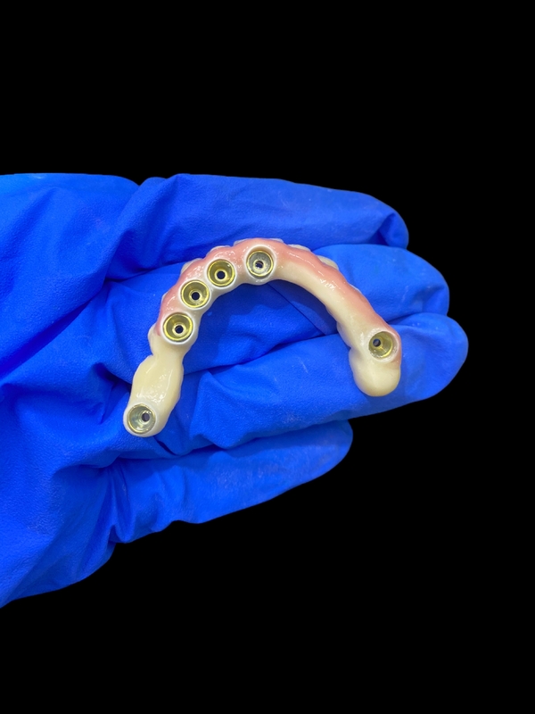 Abutment de titanio e implante de corona de zirconia Dentes postizos con soporte Precisión adecuada para el uso cómodo