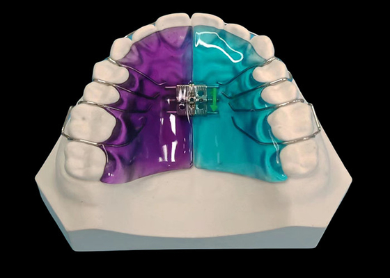 Buen precio Expansor extraíble para un tratamiento de ortodoncia eficaz y mejora de la sonrisa en línea