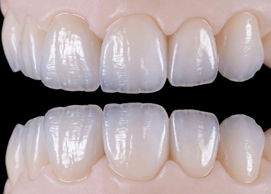 Buen precio Puente de corona dental de cerámica natural resistente al desgaste para una restauración realista en línea