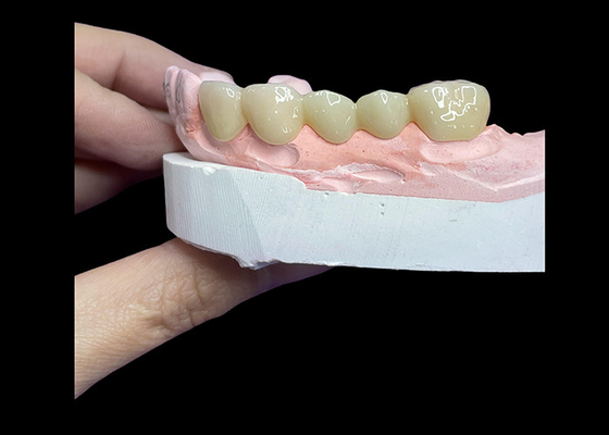 Buen precio Todas las coronas y puentes de cerámica diseñadas para una estética superior, durabilidad y ajuste natural para una confianza duradera en línea