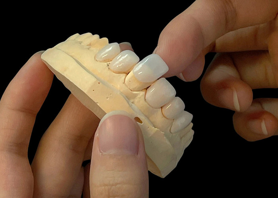 Buen precio Sombra de porcelana ultra delgada carillas EMAX resistentes a las manchas para restauraciones estéticas en línea