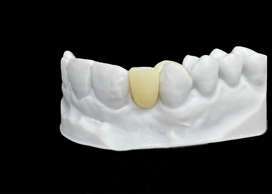 Buen precio Resistencia a las astillas Corona dental de zircónia con una resistencia y translucidez excepcionales en línea