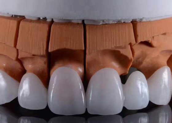 Buen precio FDA aprobó las coronas dentales de zirconia translúcidas. en línea