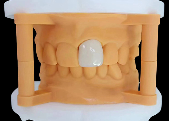 Buen precio Corona dental de zircónia translúcida con rendimiento estético de China Dental Lab en línea