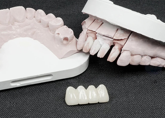 Buen precio Coronas dentales de zirconia de primera calidad para una resistencia superior y una estética natural en línea