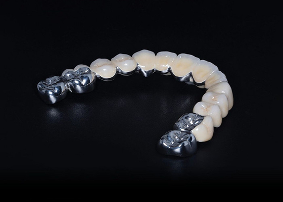 Buen precio Porcelana biocompatible de alta durabilidad fusionada con corona de metal ajuste preciso personalizado en línea