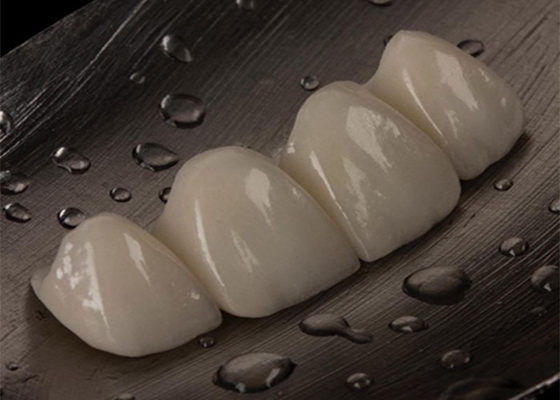 Buen precio Puente de corona de cerámica personalizable para dientes perdidos cómodo ajuste perfecto en línea