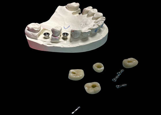 Buen precio Superficie pulida para implantes dentales tornillo de corona retenida para reemplazo dental en línea
