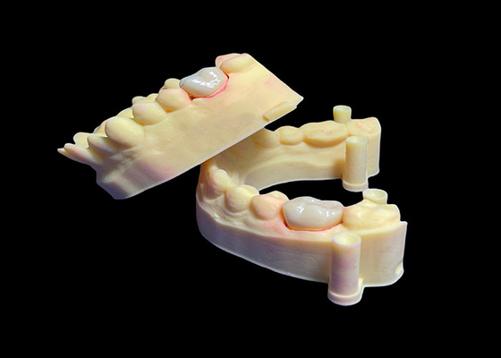 Buen precio Corona de zirconia dental biocompatible para dientes simples / múltiples de alta resistencia en línea