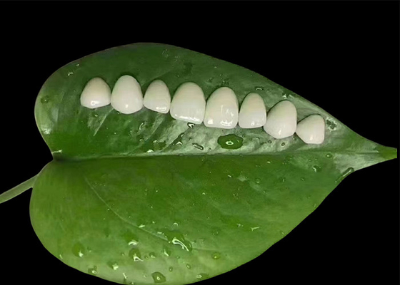 Buen precio Preparación mínima Veneer de porcelana EMAX para el tratamiento dental cosmético en línea