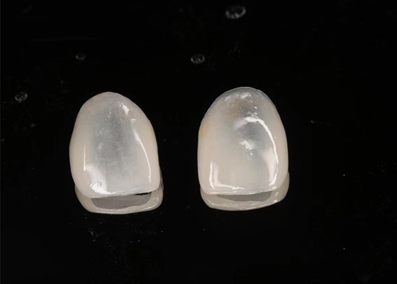 Buen precio Restauración estética Veneceras cerámicas Emax Translucidez con superficie pulida en línea