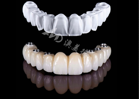 Buen precio Precio asequible, corona completa de zirconio, corona dental de zirconio de alta resistencia. en línea