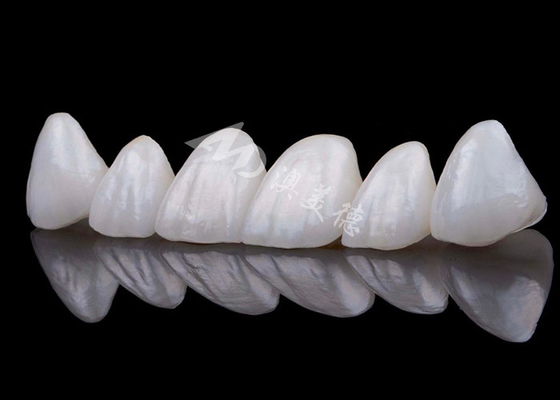 Buen precio Coronilla de dientes de zircón de aspecto natural Resistencia a manchas Toda la corona de zircón en línea