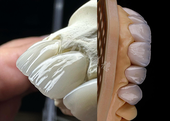 Buen precio Dental de larga duración, corona de zirconio sólida, dientes de corona de ajuste preciso laboratorio dental de zirconio en línea
