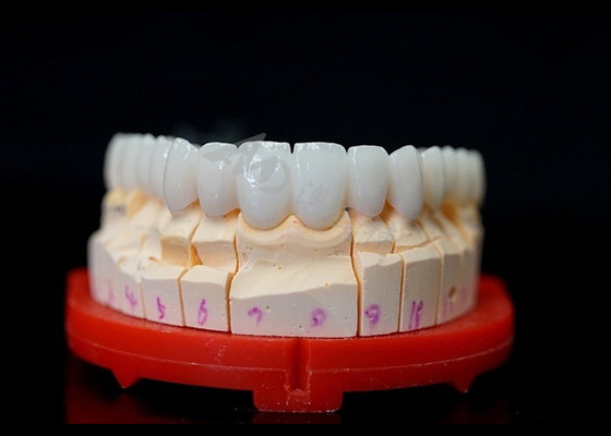 Buen precio Coronas de zirconio de ajuste preciso, coronas de zirconio altamente biocompatibles para dientes. en línea