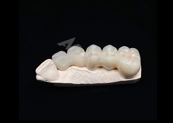 Buen precio Translucidez Estética natural Corona de zirconia sólida para dientes Resistente a las roturas en línea