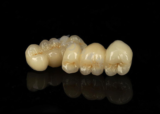 Buen precio Corona de zircónia sólida resistente a las manchas que combina una excelente biocompatibilidad en línea