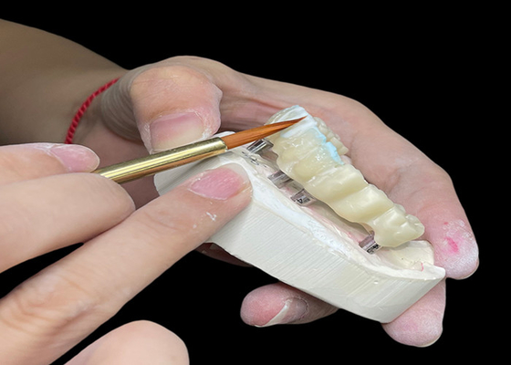 Buen precio Implante dental pulido personalizado Puente de corona duradero para una higiene fácil en línea