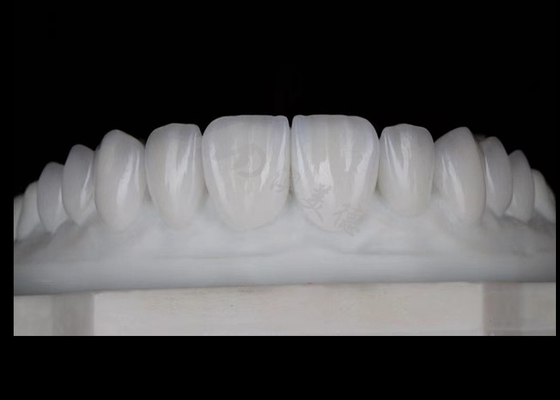 Buen precio Translucidez Natural Estética Coronas de zirconia Excelente biocompatibilidad y resistencia en línea