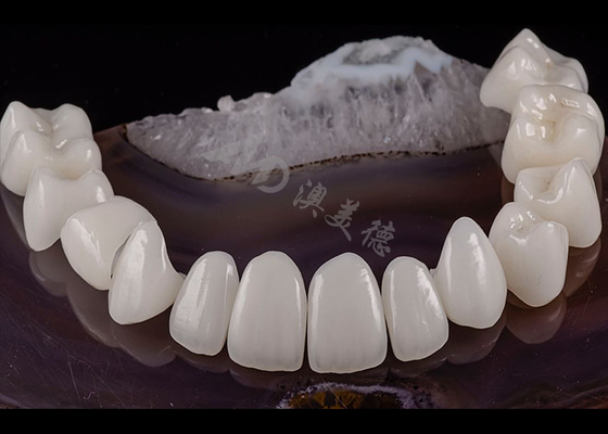 Buen precio Diente dental translúcido Coroneta de zirconio sólido Estética natural Resistencia a las astillas en línea