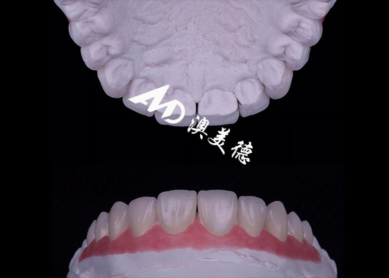 Buen precio Translucidez Veneer de porcelana EMAX Resistente a las manchas / resistencia en línea