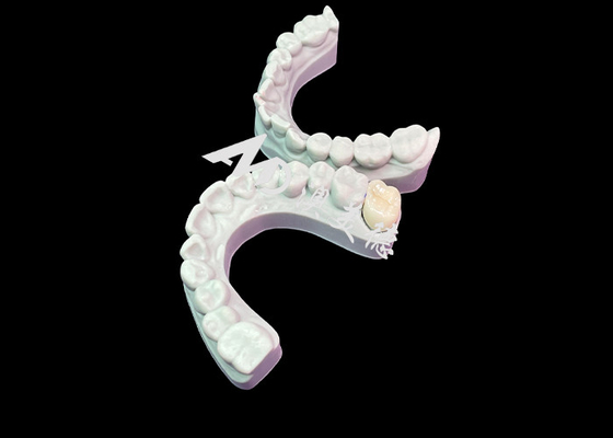 Buen precio Ajuste preciso Coroa dental de zirconio Estética Color natural Excelente biocompatibilidad en línea