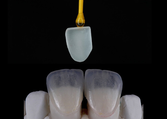 Buen precio Restauración dental hecha a medida Veneers EMAX Impresión digital bellamente alineada en línea