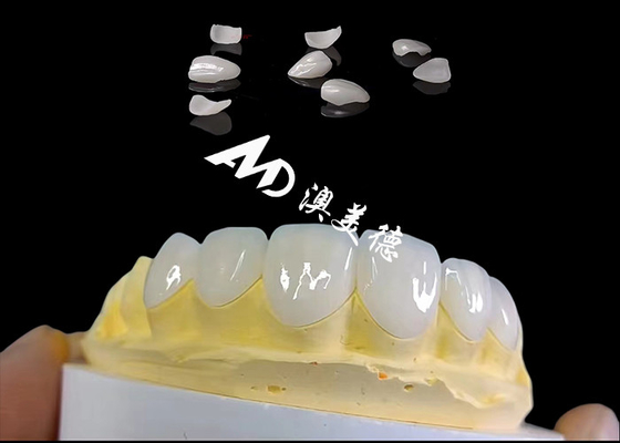 Buen precio Translucidez IPS carillas Emax, Preparación mínima carillas dental Emax en línea