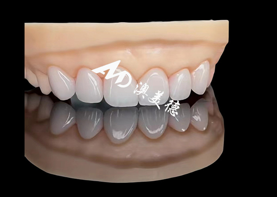 Buen precio Porcelana EMAX Veneer Restauraciones estéticas de alta precisión con una durabilidad superior en línea