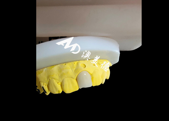 Buen precio Coronas dentales de zirconia de aspecto natural y estético Restauración de dientes de ajuste perfecto en línea