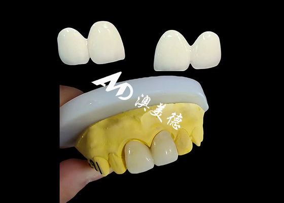 Buen precio Corona dental de zirconio personalizada con tapa dental ajustada de laboratorio dental de China en línea