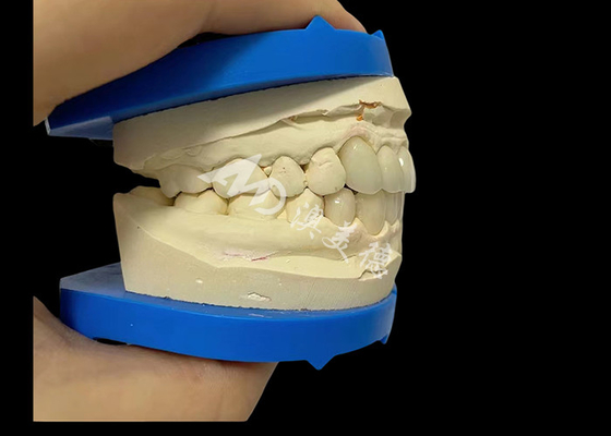 Buen precio Inmejorable fuerza Dental Zirconia Dentla Corona para sonrisas de aspecto natural en línea
