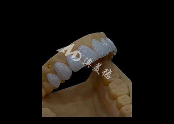 Buen precio Prótesis Dentística Circonia Corona Dental Estética de ajuste preciso Para dientes de arco completo en línea