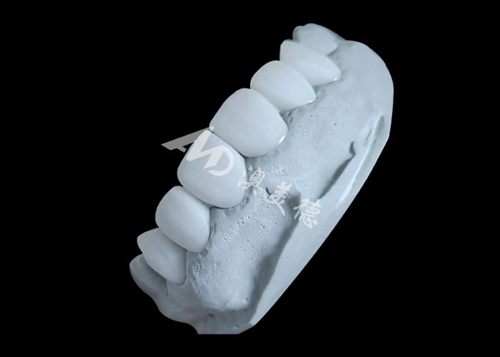 Buen precio Coronas dentales de zirconia que ofrecen una fuerza inmejorable y suavidad natural, y una translucidez natural. en línea